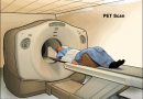 Iby’ingenzi wamenya ku mashini ya PET Scan yifashisha imbaraga za nucléaire mu gupima, imashini itegerejwe vuba aha mu Rwanda